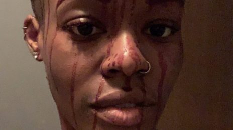 Azealia Banks Shares Disturbing Selfie Of Herself Covered In Blood