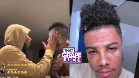 Watch: Chrisean Rock Admits To Giving Blueface TWO Black Eyes?