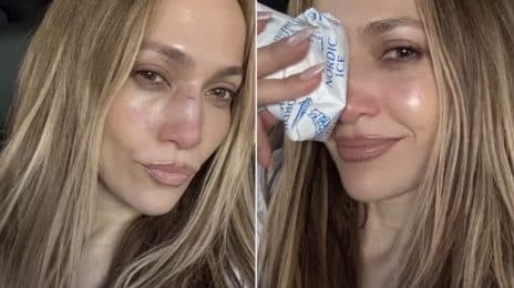 Jennifer Lopez Injured in Rehearsals for American Music Awards 2025