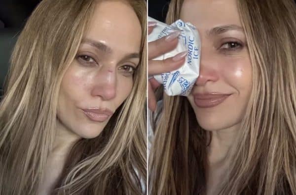 Jennifer Lopez injured
