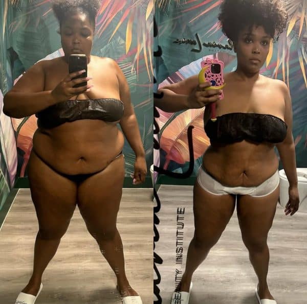Lizzo Reveals Weight-Loss Before & After Pictures, Continues to Deny Ozempic Use