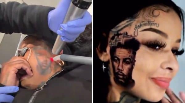 Chrisean Rock removes Blueface face tattoo